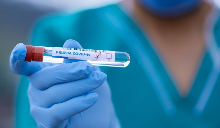 Covid-19 στην Ελλάδα: 183 νέα κρούσματα και τέσσερις νεκροί από χθες έως σήμερα