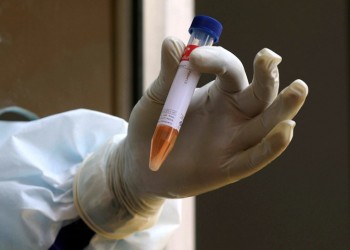 Κρούσματα κορονοϊού σε οίκο ευγηρίας στα Ιωάννινα