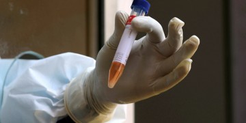 Κρούσματα κορονοϊού σε οίκο ευγηρίας στα Ιωάννινα