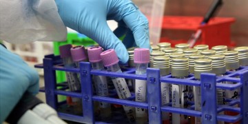 Κρούσματα κορονοϊού σε οίκο ευγηρίας στα Ιωάννινα