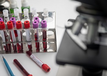 Κορονοϊός: 267 νέα κρούσματα και 7 θάνατοι 2