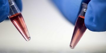 (Φωτ.: EPA / Jeffrey Arguedas)