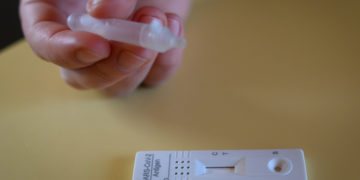 (Φωτ.: EPA / Philipp Guelland)