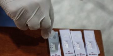 (Φωτ.: EUROKINISSI / Γιώργος Κονταρίνης)