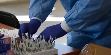 Κλιμάκιο του ΕΟΔΥ κάνει rapid-test στο Δήμο Διονύσου (φωτ.:
EUROKINISSI/Μιχάλης Καραγιάννης)