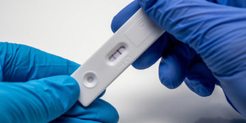 (Φωτ.: pixabay.com / Matthias_koll_leverkusen)