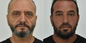 Ηλίας Μίχος και Ιωάννης Σοφιανίδης, οι δύο κατηγορούμενοι, μεταξύ άλλων, για το βιασμό της 12χρονης στον Κολωνό (φωτ.: astynomia.gr)