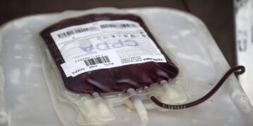 Μονάδα αίματος μετά από αιμοδοσία (φωτ.: ΜΟΤΙΟΝΤΕΑΜ/Ραφαήλ Γεωργιάδης)