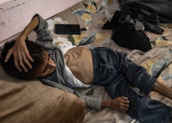 Ο πεντάχρονος Οσάμα υποφέρει από οξύ υποσιτισμό και δέχεται θεραπεία σε νοσοκομείο στη Χαν Γιουνίς, στη νότια Γάζα (φωτ.: EPA/Haitham Imad)