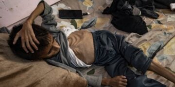 Ο πεντάχρονος Οσάμα υποφέρει από οξύ υποσιτισμό και δέχεται θεραπεία σε νοσοκομείο στη Χαν Γιουνίς, στη νότια Γάζα (φωτ.: EPA/Haitham Imad)