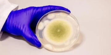 Δείγμα του μύκητα Aspergillus flavus, στο εργαστήριο (φωτ.: Bella Ciervo)