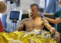 O Γιάννης Ζεντέλης μετά τον τραυματισμό του (φωτ.: zarpanews.gr)