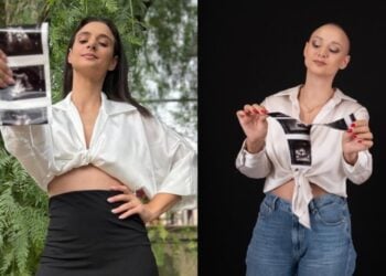 Αριστερά, Μαρία Αριστοτέλους με το υπερηχογράφημα με το οποίο ανακάλυψε τον καρκίνο και δεξιά, μετά από μια σειρά θεραπειών, όπου αρχικά φάνηκε ότι είχε θεραπευτεί (φωτ.: instagram/mariaaristotelus)