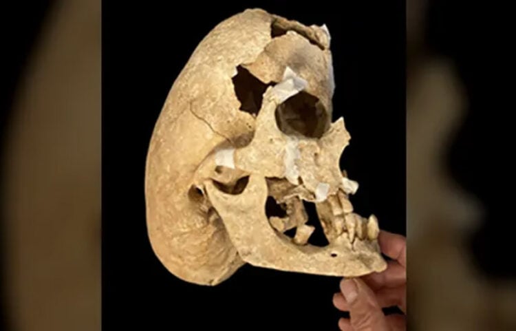 Το... παράξενο κρανίο του μεσήλικα ιππότη, το οποίο βρέθηκε σε μεσαιωνικό νεκροταφείο στην Ισπανία (φωτ.: Rissech et al. / Heritage)