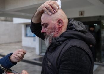 Τραυματίας μεταφέρεται σε νοσοκομείο στη Λαττάκεια μετά τα επεισόδια που σημειώθηκαν κατά τη διάρκεια διαδήλωσης Αλαουιτών (φωτ.: EPA / Ahmad Fallaha)