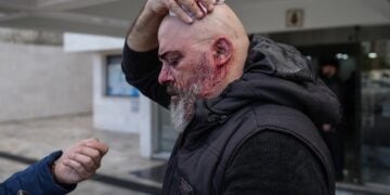 Τραυματίας μεταφέρεται σε νοσοκομείο στη Λαττάκεια μετά τα επεισόδια που σημειώθηκαν κατά τη διάρκεια διαδήλωσης Αλαουιτών (φωτ.: EPA / Ahmad Fallaha)