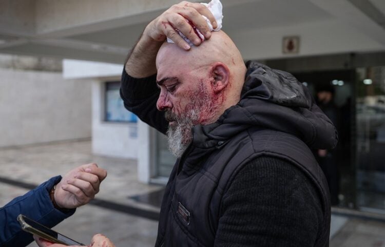 Τραυματίας μεταφέρεται σε νοσοκομείο στη Λαττάκεια μετά τα επεισόδια που σημειώθηκαν κατά τη διάρκεια διαδήλωσης Αλαουιτών (φωτ.: EPA / Ahmad Fallaha)