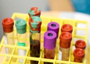 Δείγματα αίματος στο Κλινικό Κέντρο των Εθνικών Ινστιτούτων Υγείας των ΗΠΑ – Φωτογραφία αρχείου (φωτ.: National Cancer Institute / Daniel Sone)