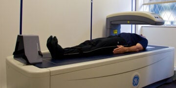 Εξέταση με σύστημα DXA στην κλινική της μελέτης ALSPAC στο Μπρίστολ της Βρετανίας (φωτ.: Wikimedia Commons / Nick Smith)